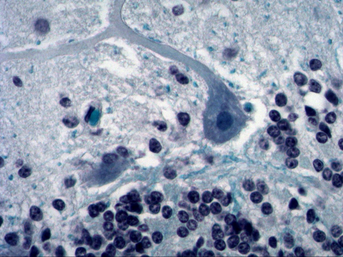 Purkinje cell with nucleus, nucleolus and branching dendrite, Fast Blue, high magnification