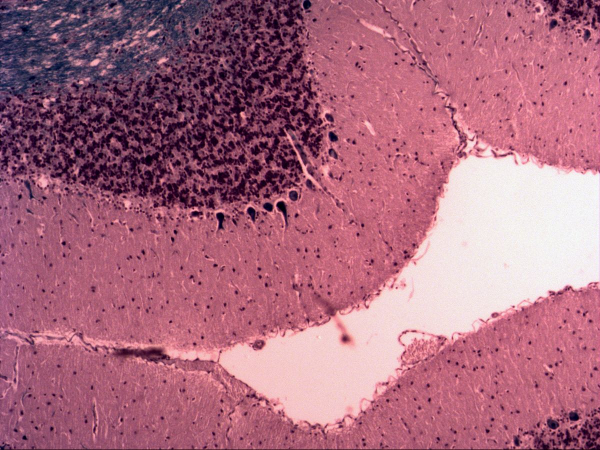 Cerebellar cortex, H&E/Klüver, overview: white matter, granular layer, Purkinje cell row, molecular layer