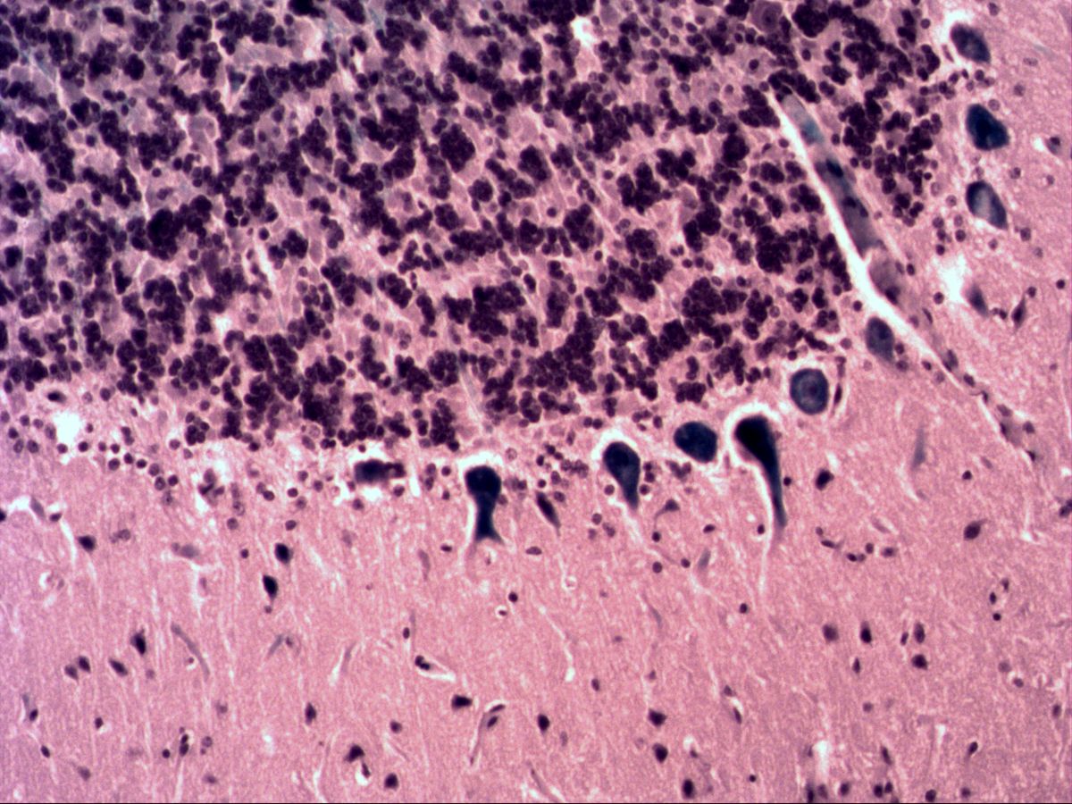 Row of Purkinje cells between granular and molecular layers, H&E, medium magnification