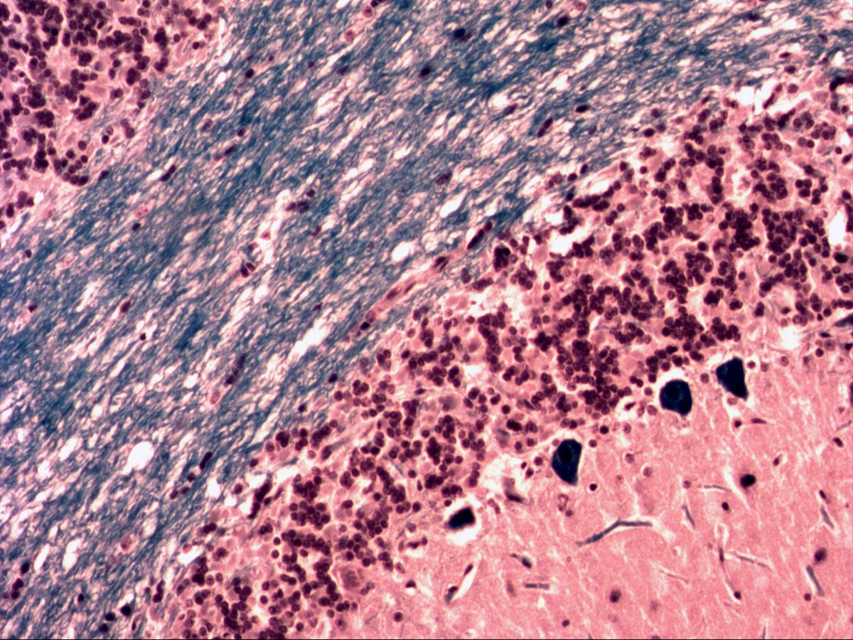 Cerebellum with white matter, granular layer, Purkinje cells and molecular layer, medium magnification
