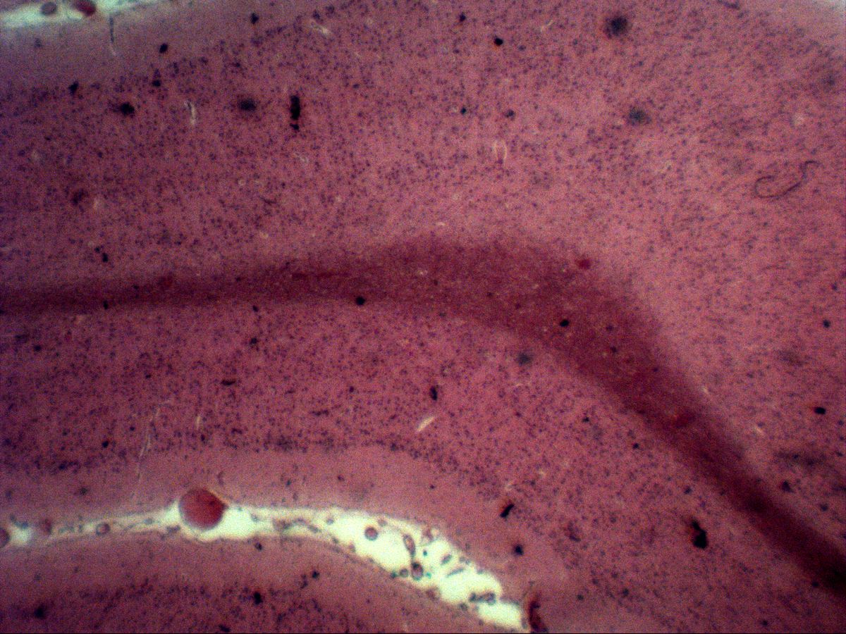 Cerebral cortex, H&E, overview with cleft, blood vessel and tissue fold