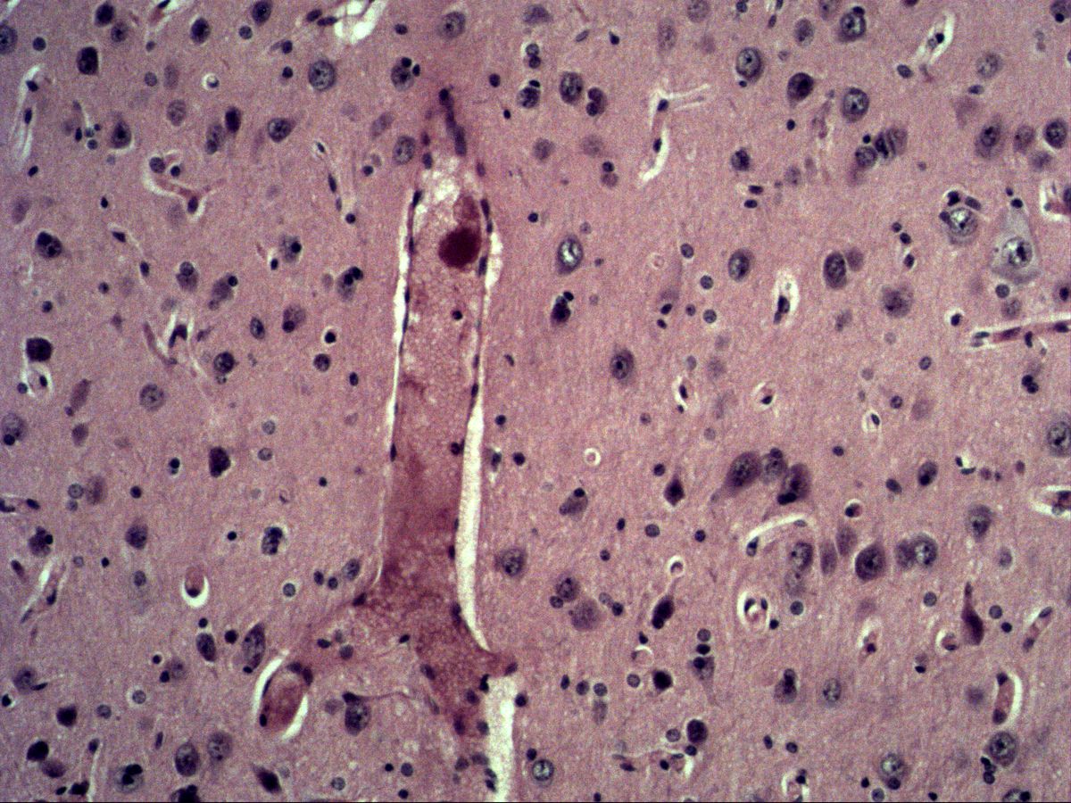 Cerebral cortex, H&E, medium magnification: neurons, glial nuclei and blood vessel