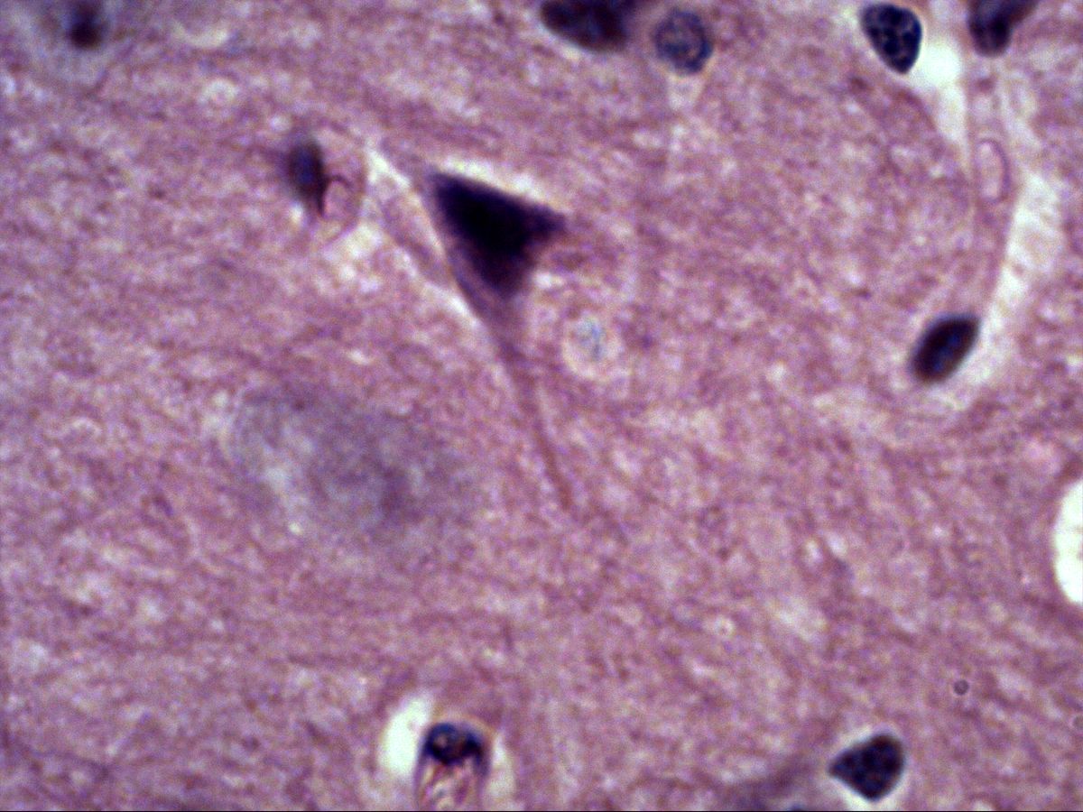 Pyramidal cell with triangular soma and dendrite, H&E, high magnification
