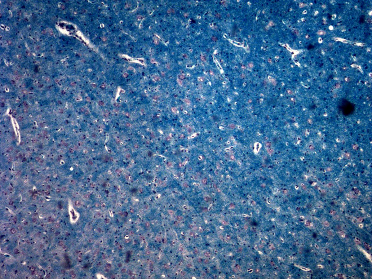 Cerebral cortex, Fast Blue, medium magnification: neurons in blue neuropil