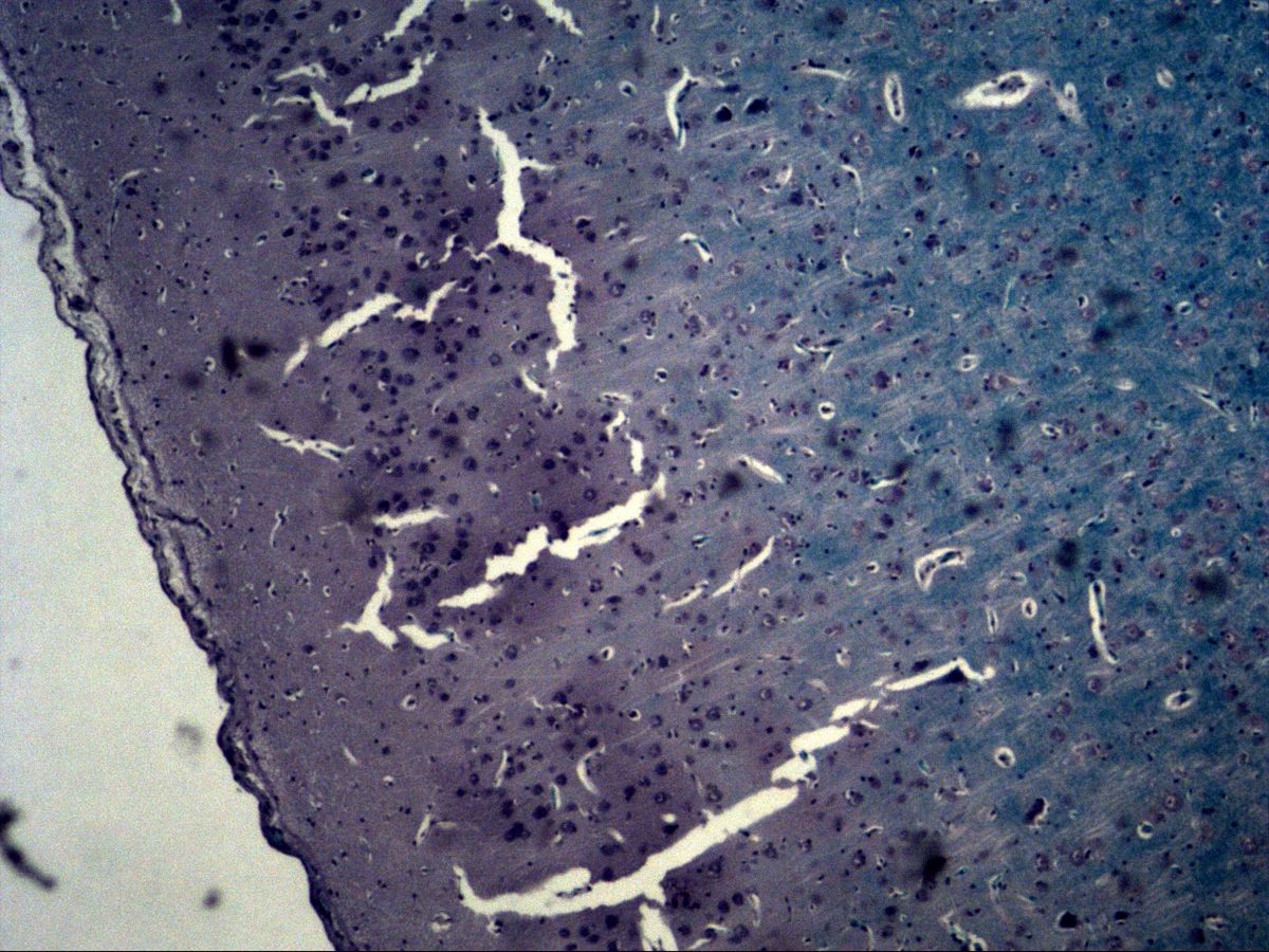 Cerebral cortex, Fast Blue, overview with brain surface, pia mater and cortical layers