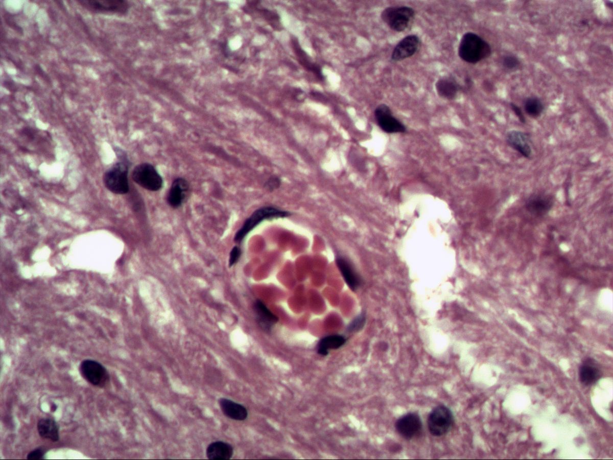 Capillary with red blood cells in cerebral cortex neuropil, H&E, high magnification