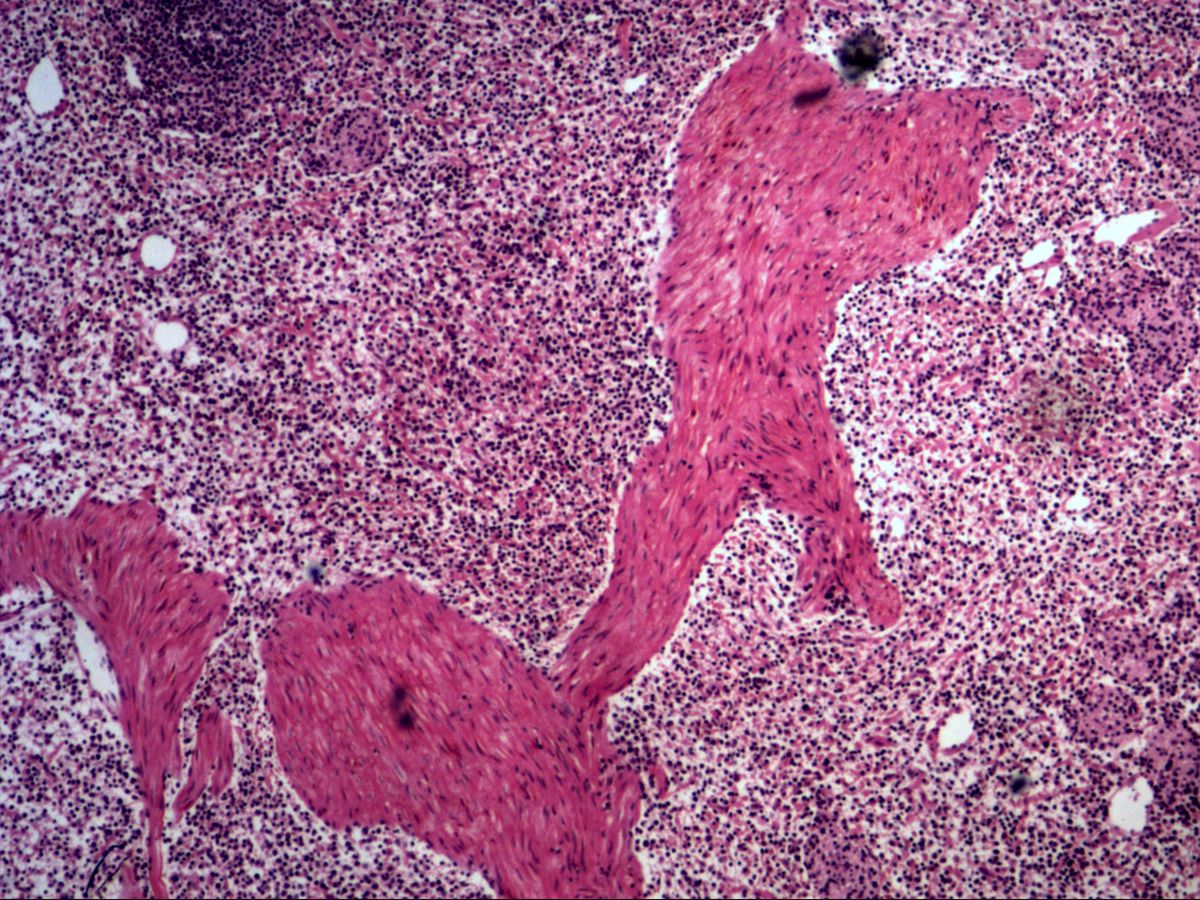 Perfused spleen, H&E, overview with trabeculae and reticular tissue of the pulp