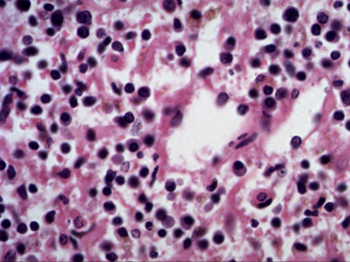 Red pulp of perfused spleen, H&E, high magnification with lymphocytes and reticular meshwork