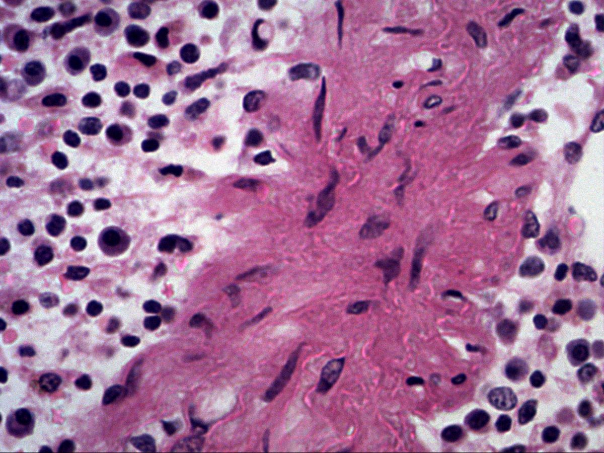 Splenic trabecula and adjacent reticular tissue with free cells, H&E, high magnification