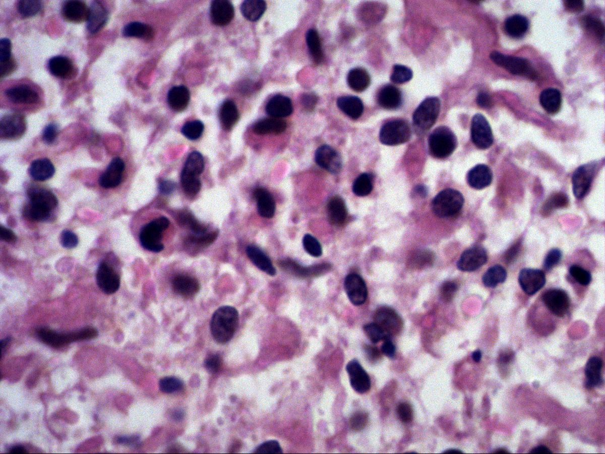 Reticular tissue of the spleen with lymphocytes and pale-nucleated cells, H&E, high magnification