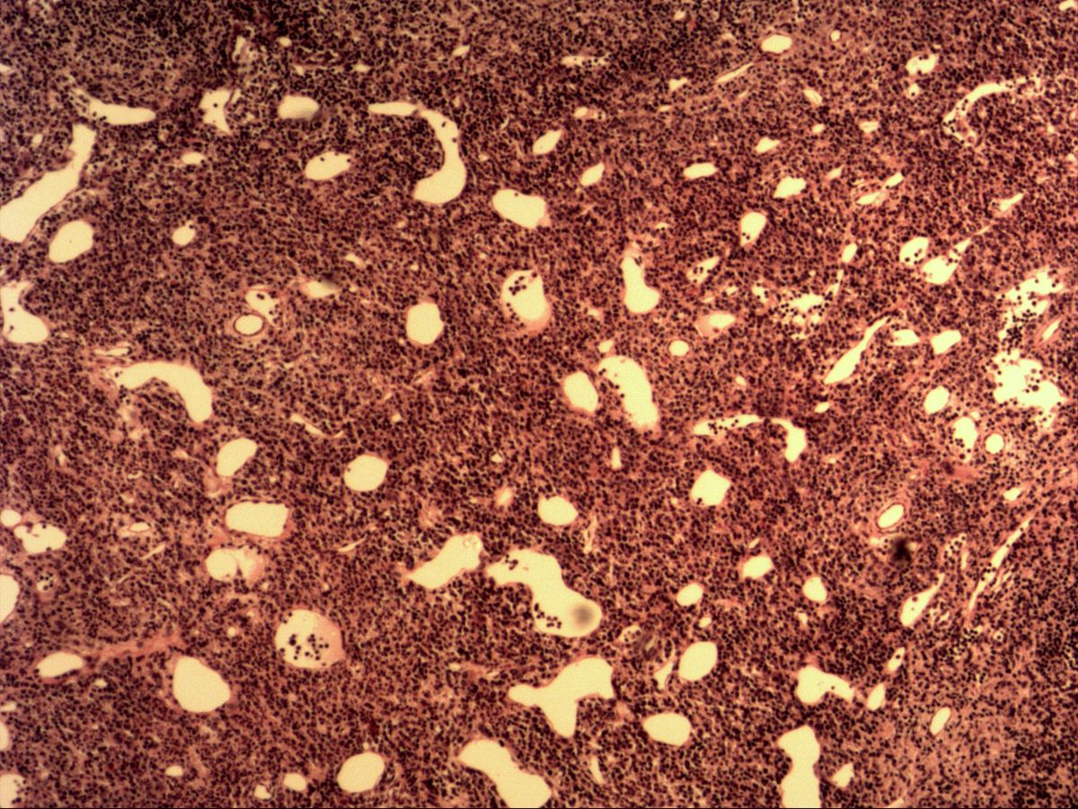 Probably spleen, H&E, overview with many washed-out sinuses between cell cords