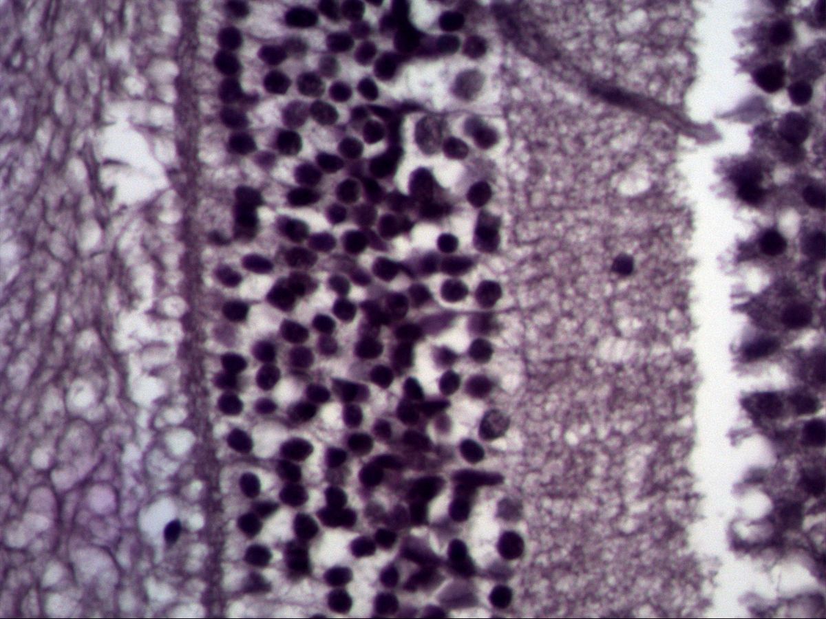 Retina, high magnification: nuclear layer with round nuclei next to a plexiform layer