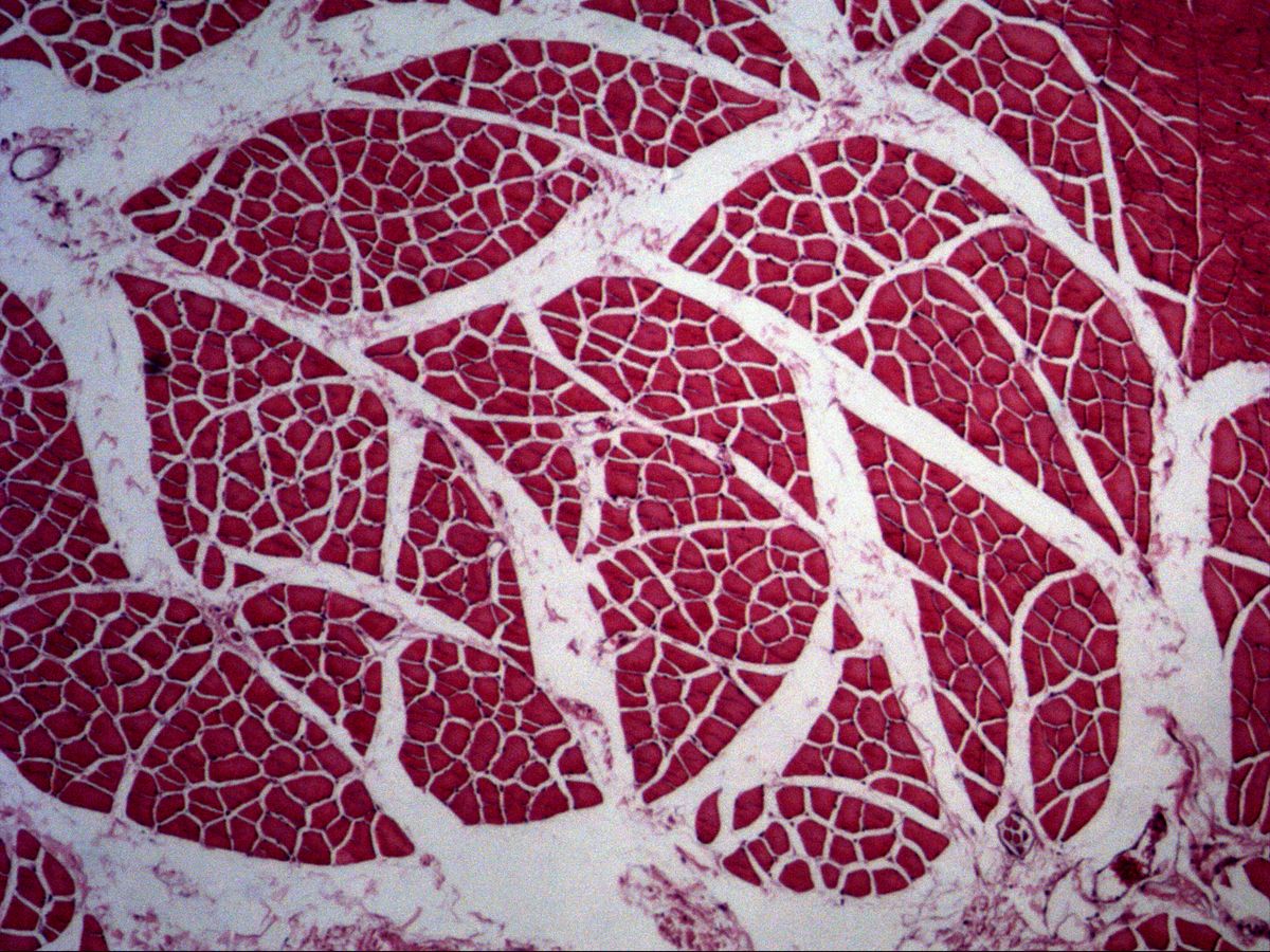 Masseter in cross-section, H&E, overview: fibre bundles, perimysium and a small muscle spindle