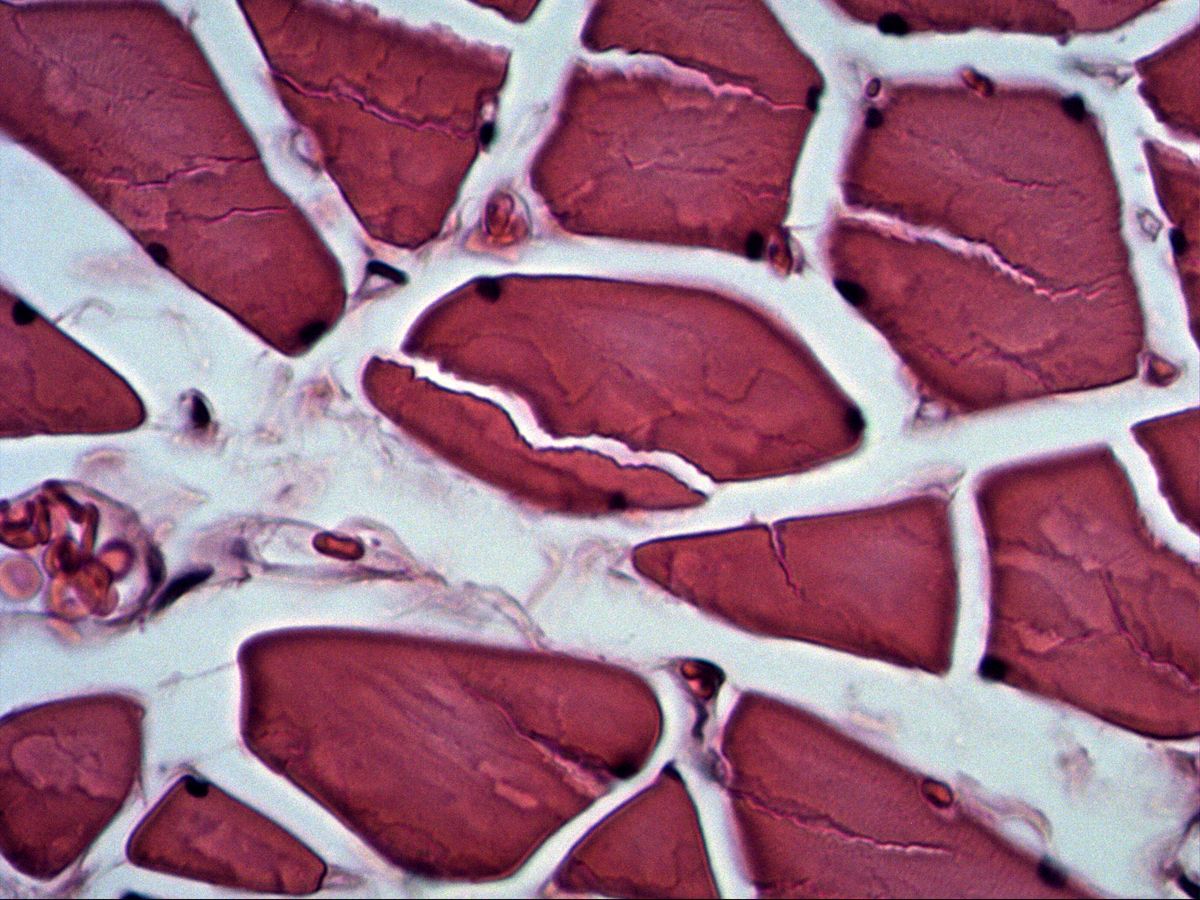 Skeletal muscle fibres in cross-section, H&E, high magnification, peripheral nuclei and capillaries