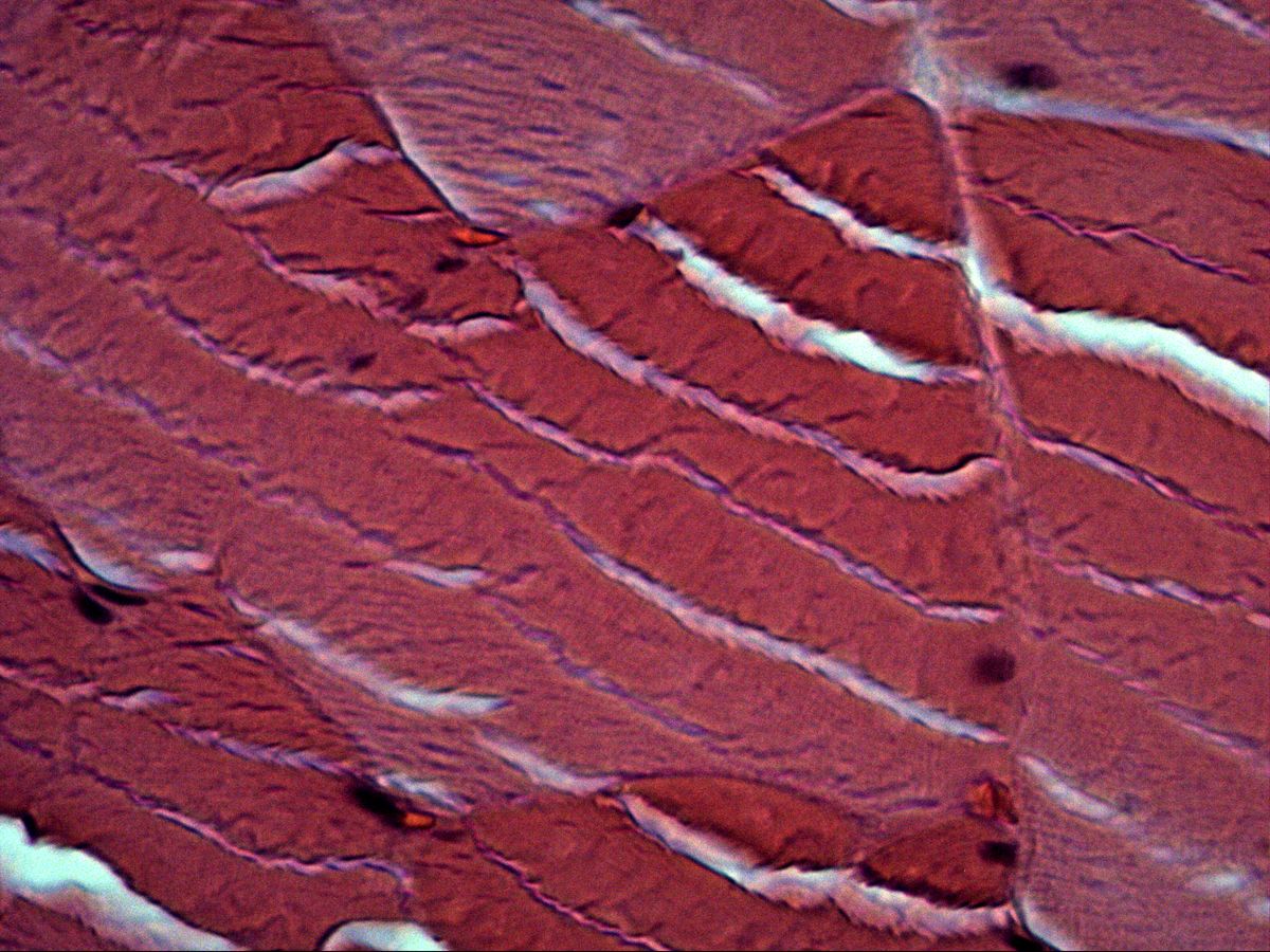 Skeletal muscle fibres cut obliquely, H&E, high magnification