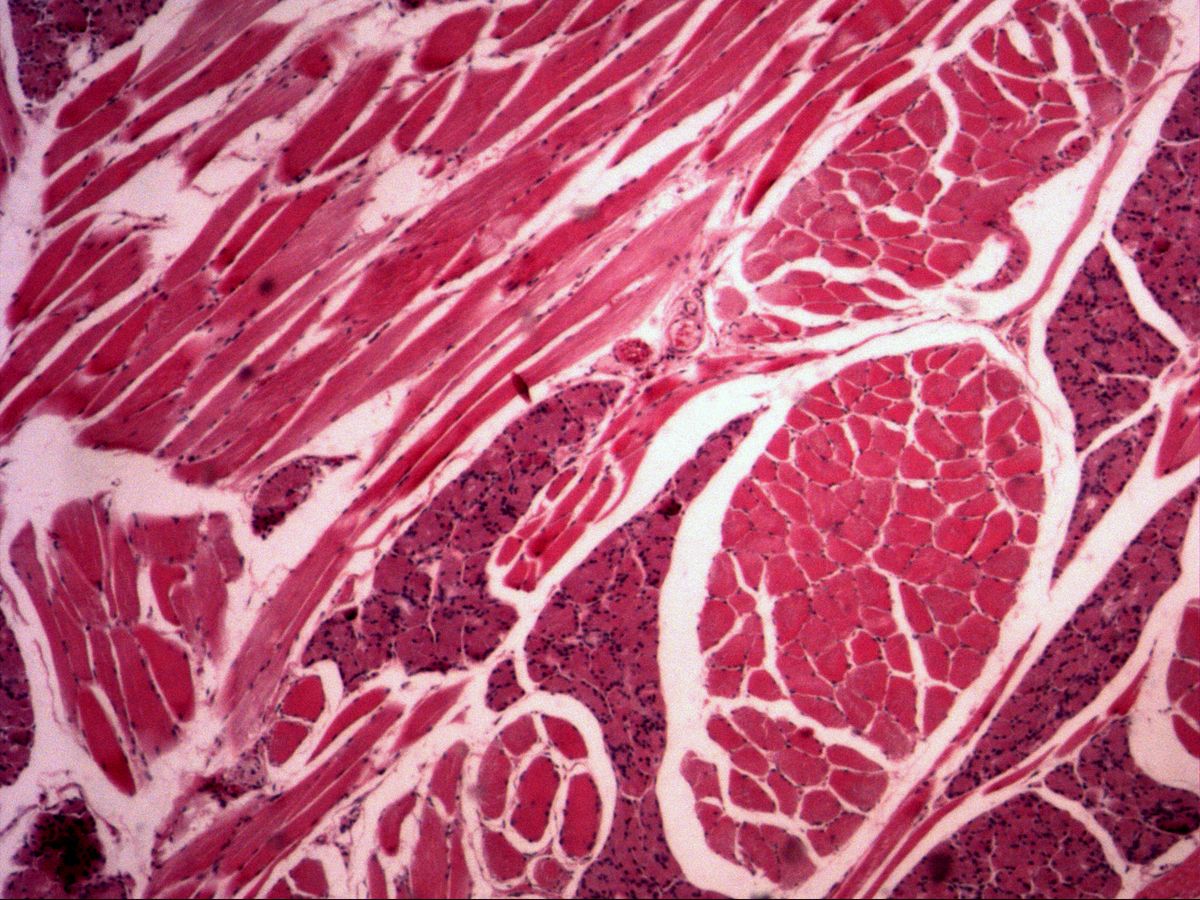 Tongue, H&E, overview: skeletal muscle bundles in different planes and lingual glands