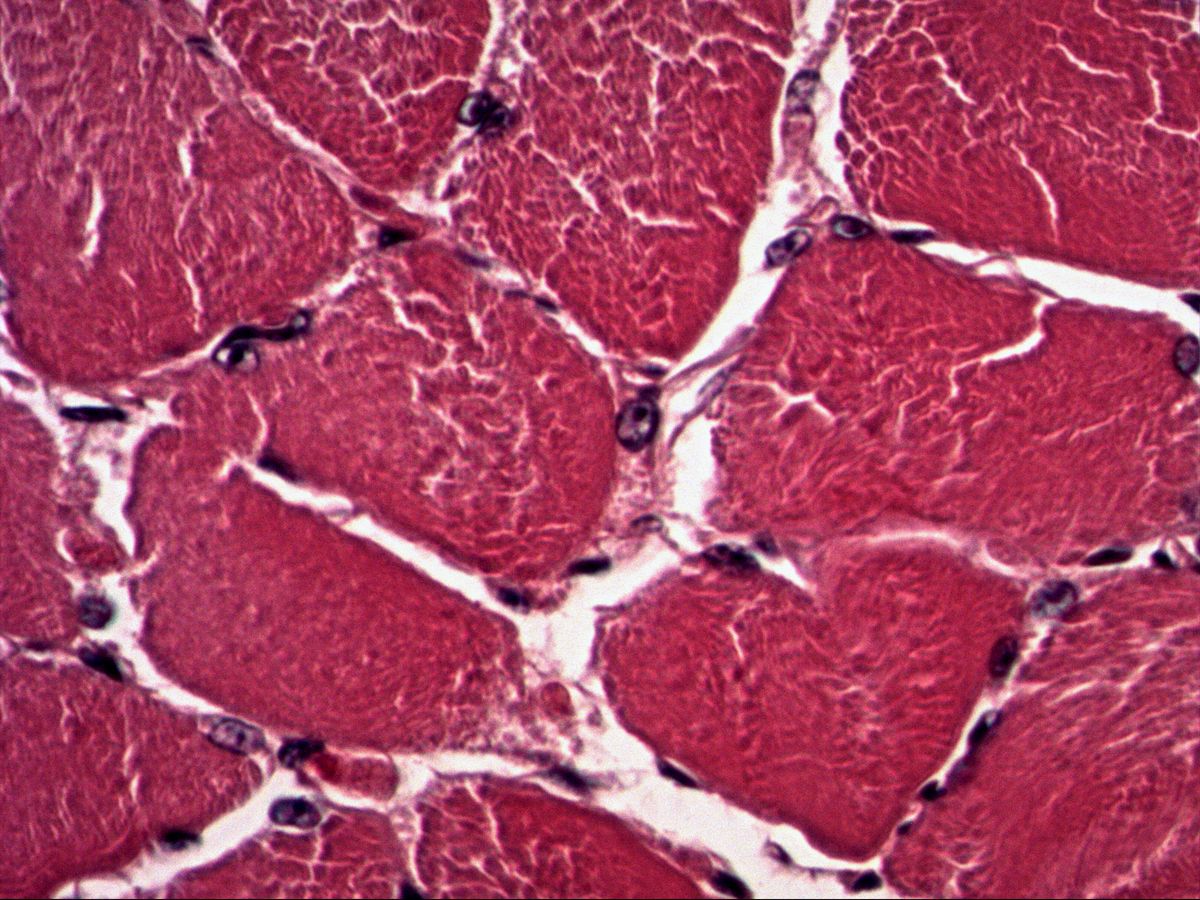 Skeletal muscle fibres in cross-section, H&E, polygonal fibres with peripheral nuclei
