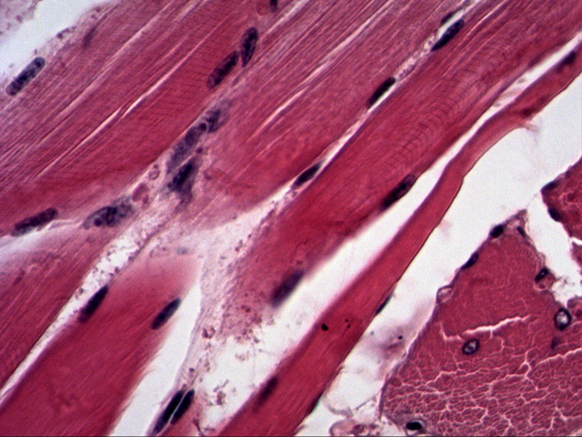 Skeletal muscle fibres in longitudinal section, H&E, high magnification, striation and peripheral nuclei