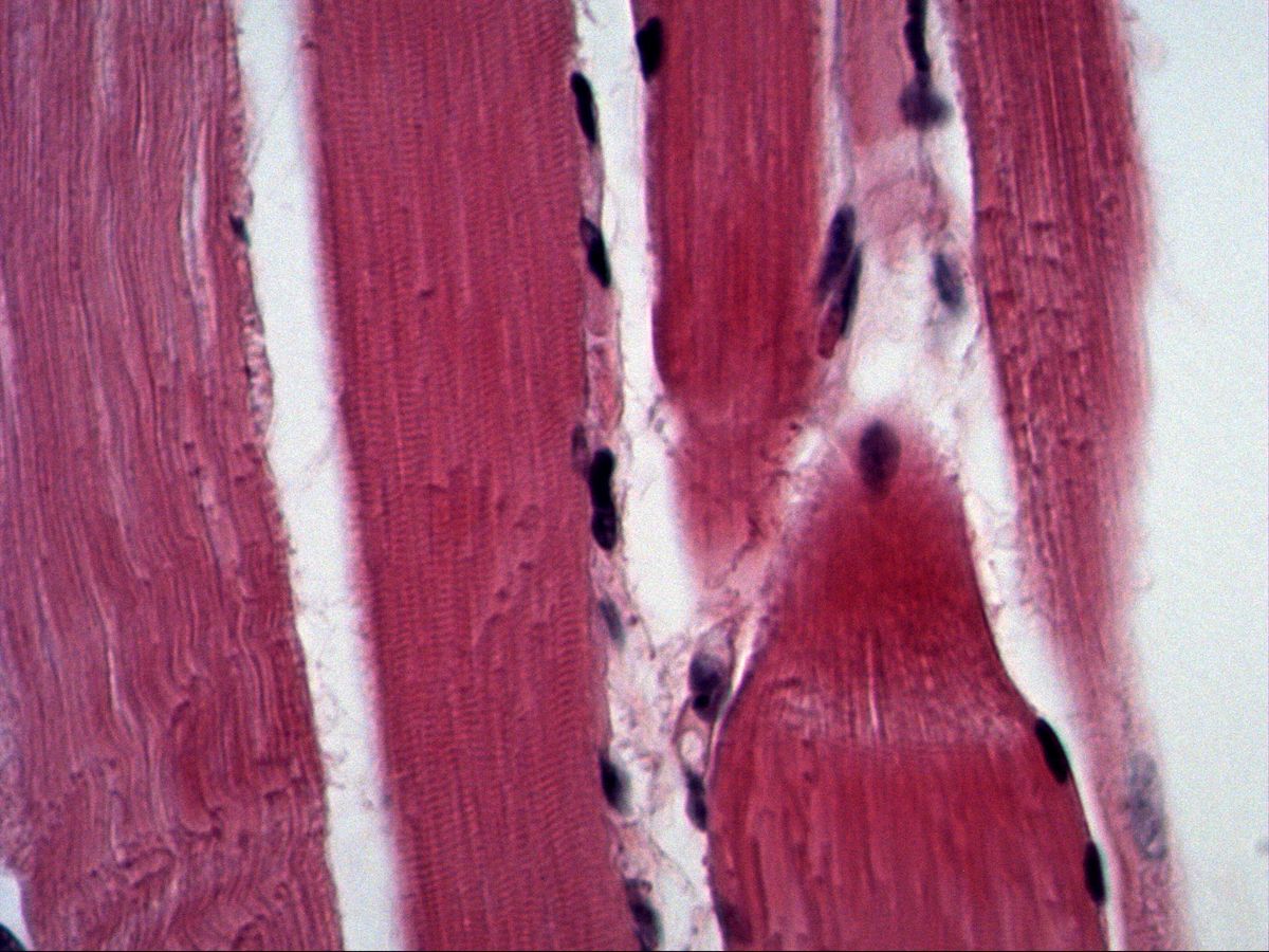 Skeletal muscle in longitudinal section, H&E, high magnification, clear A and I bands