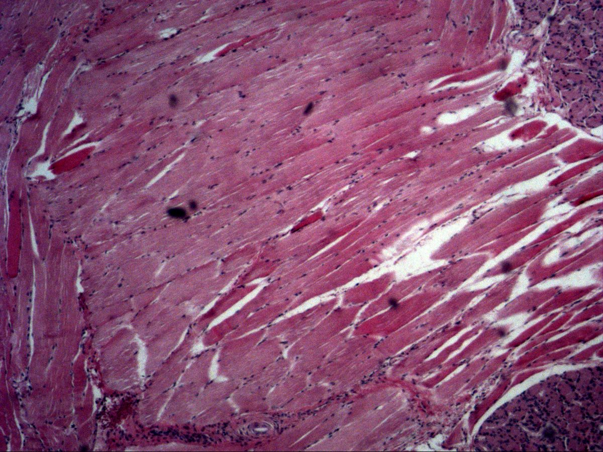 Tongue muscle, H&E, medium magnification, longitudinally and obliquely cut fibres