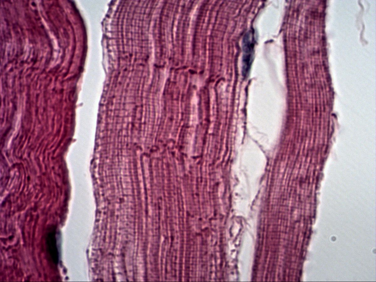 Skeletal muscle fibres in longitudinal section, H&E, high magnification, very clear striation