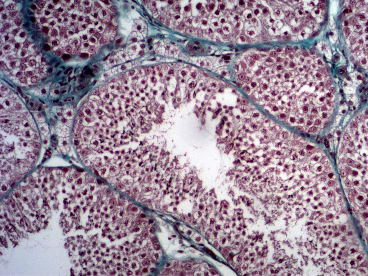 Testis, trichrome: seminiferous tubules with germinal epithelium, Sertoli and Leydig cells