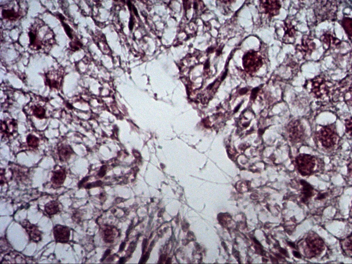 Testis, trichrome, high magnification: spermatocytes, spermatids and sperm flagella in lumen