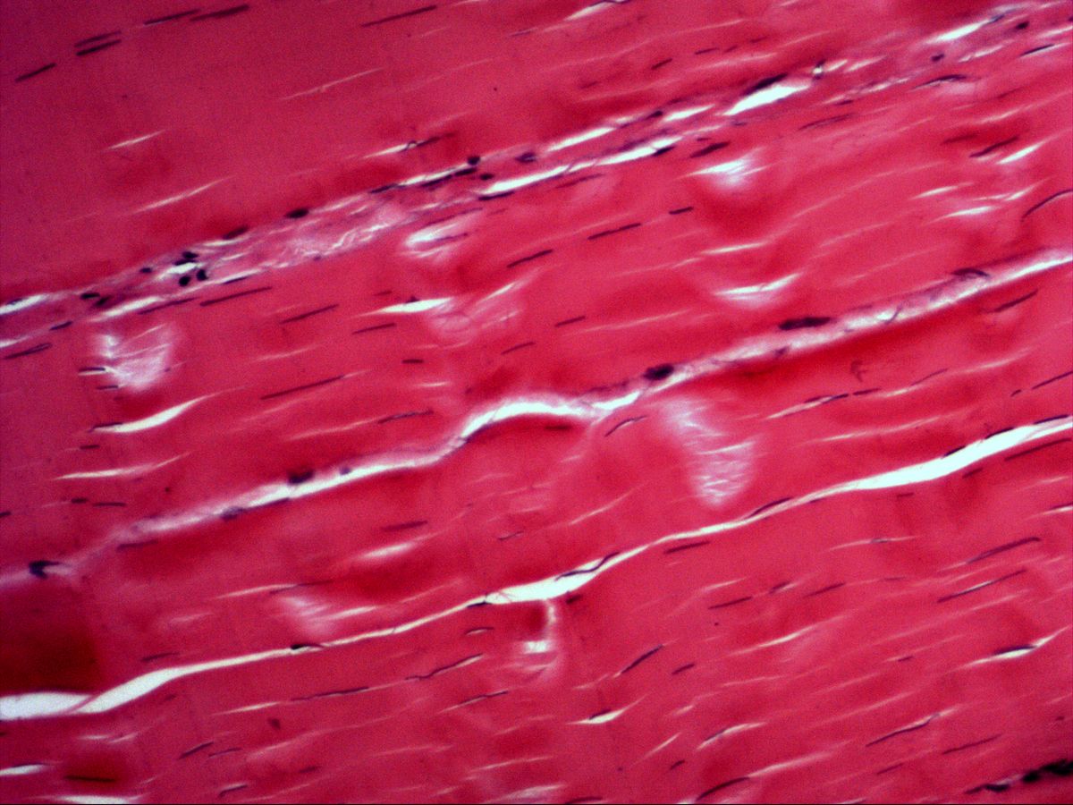 Dense regular connective tissue of tendon, H&E, medium magnification with tenocyte nuclei