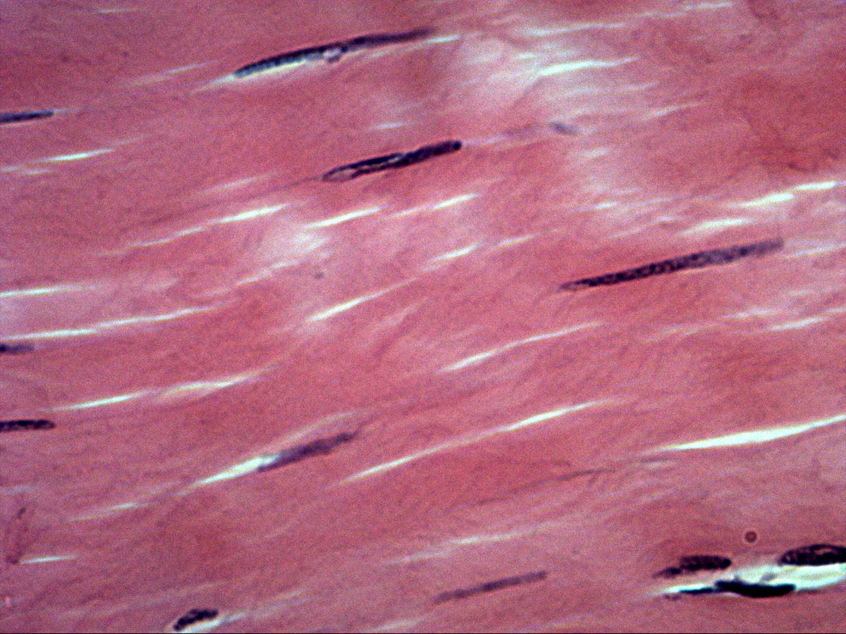 Wing-cell nuclei between collagen bundles of tendon, H&E, high magnification