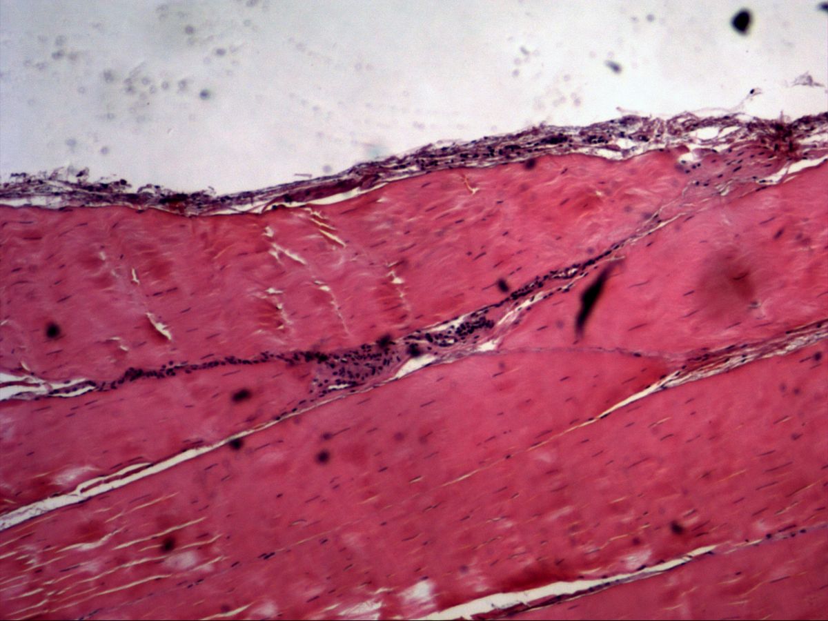 Tendon, longitudinal, H&E, with external peritendineum, parallel collagen bundles and internal peritendineum