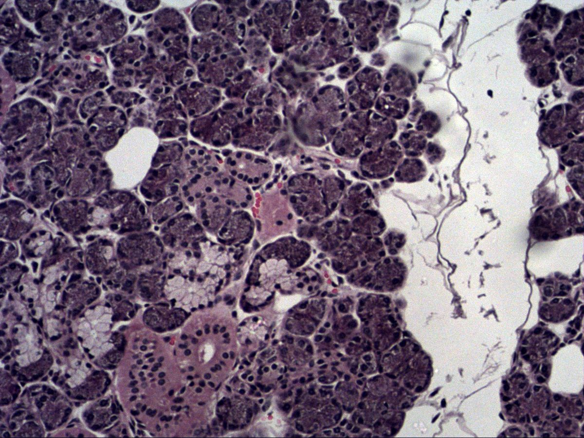 Submandibular gland, H&E: serous and mucous end pieces, demilune, excretory duct
