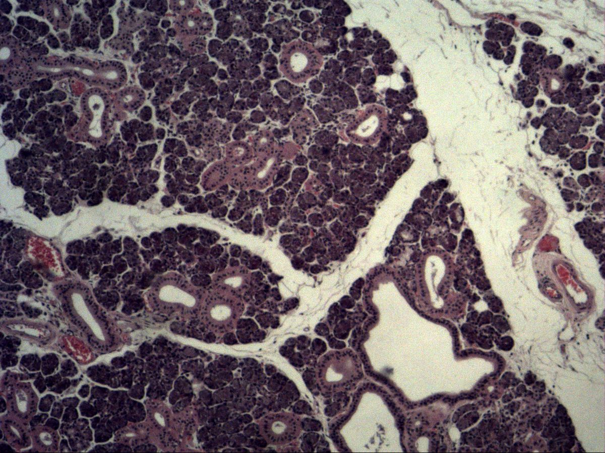 Submandibular gland, H&E, overview: lobules, striated ducts, interlobular duct