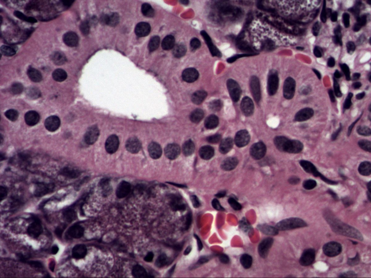 Submandibular gland, H&E, high magnification: striated duct and serous acini