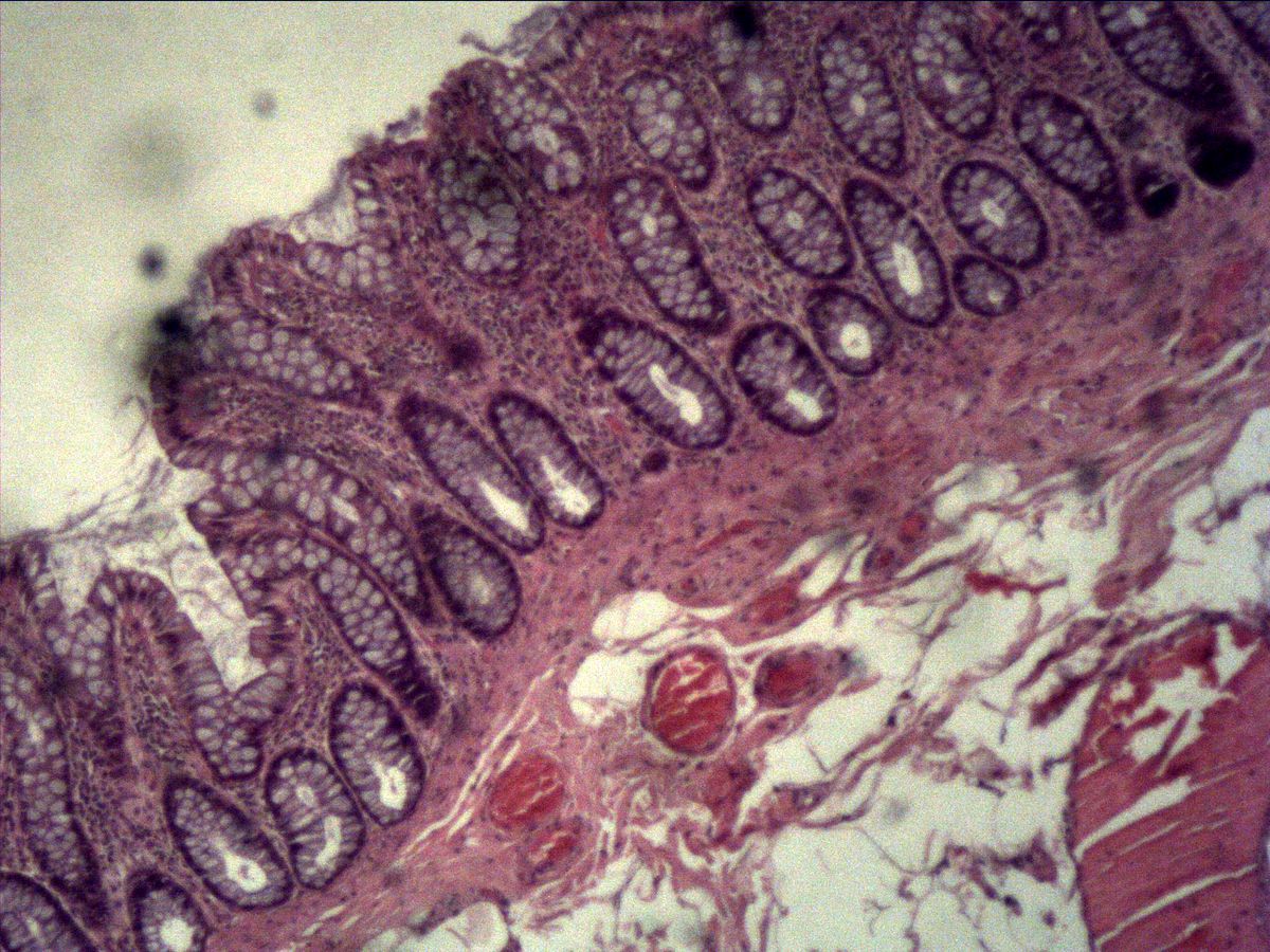 Colon, H&E, overview: tubular crypts with goblet cells, lamina propria and submucosa