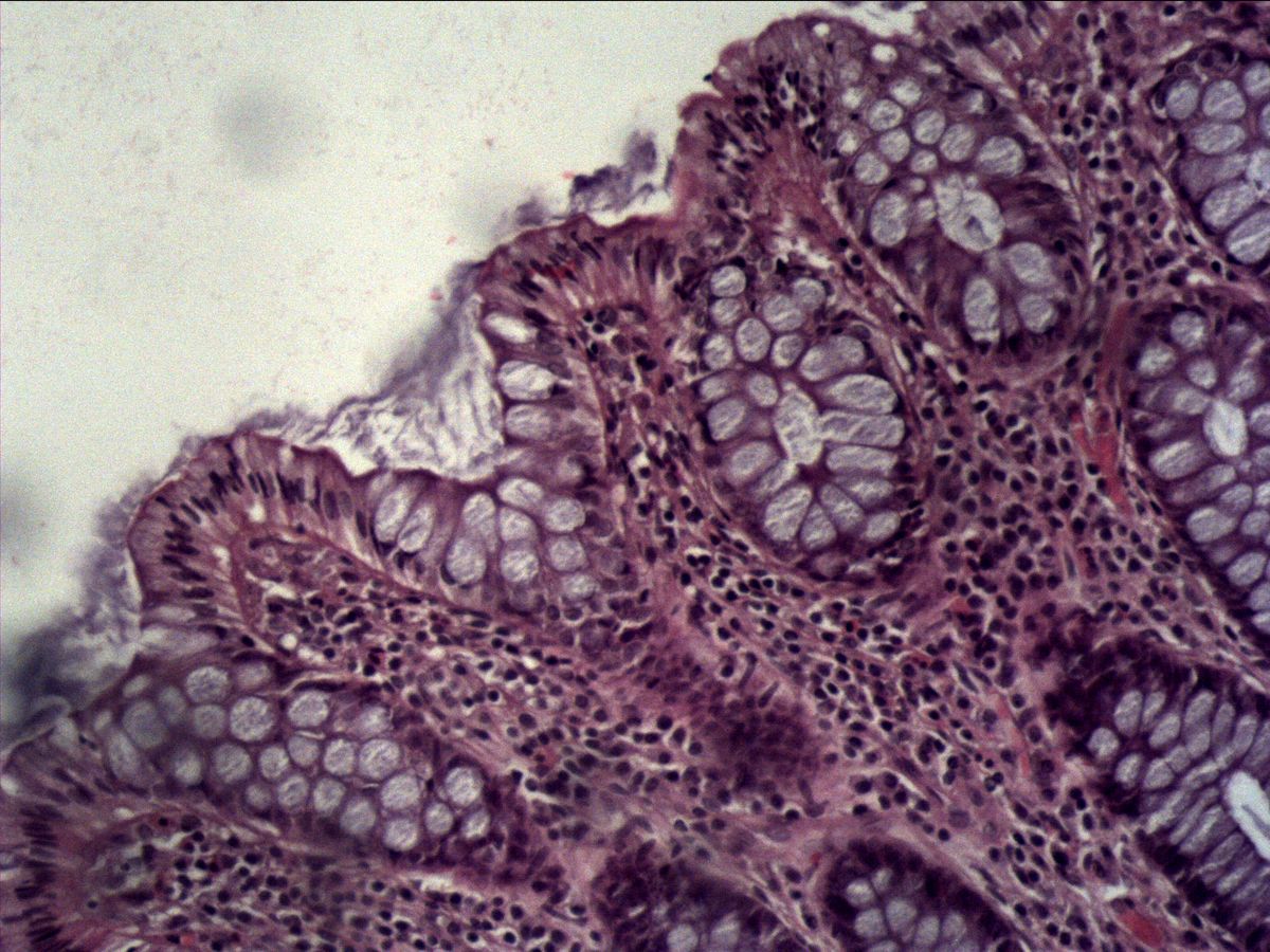 Colon, H&E, medium magnification: crypts with goblet cells and cell-rich lamina propria