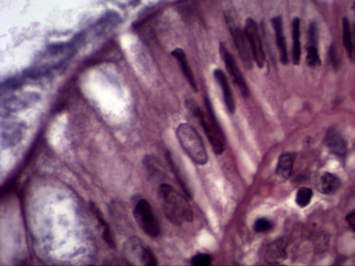 Colonic epithelium, H&E, high magnification: goblet cells, absorptive cells and luminal mucus