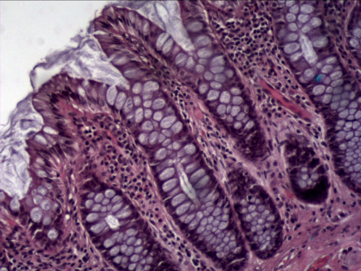 Colon mucosa, H&E, medium magnification: crypts with numerous goblet cells and lamina propria