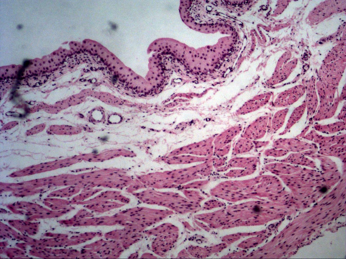 Urinary bladder, H&E, overview: urothelium, lamina propria and muscular layer