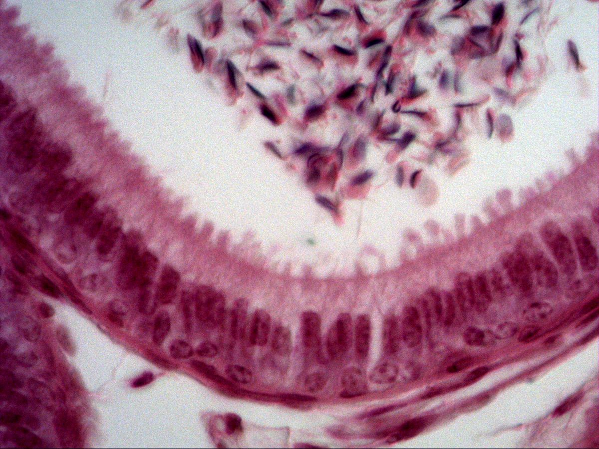 Epididymis, H&E, high power: pseudostratified epithelium with stereocilia, sperm in the lumen