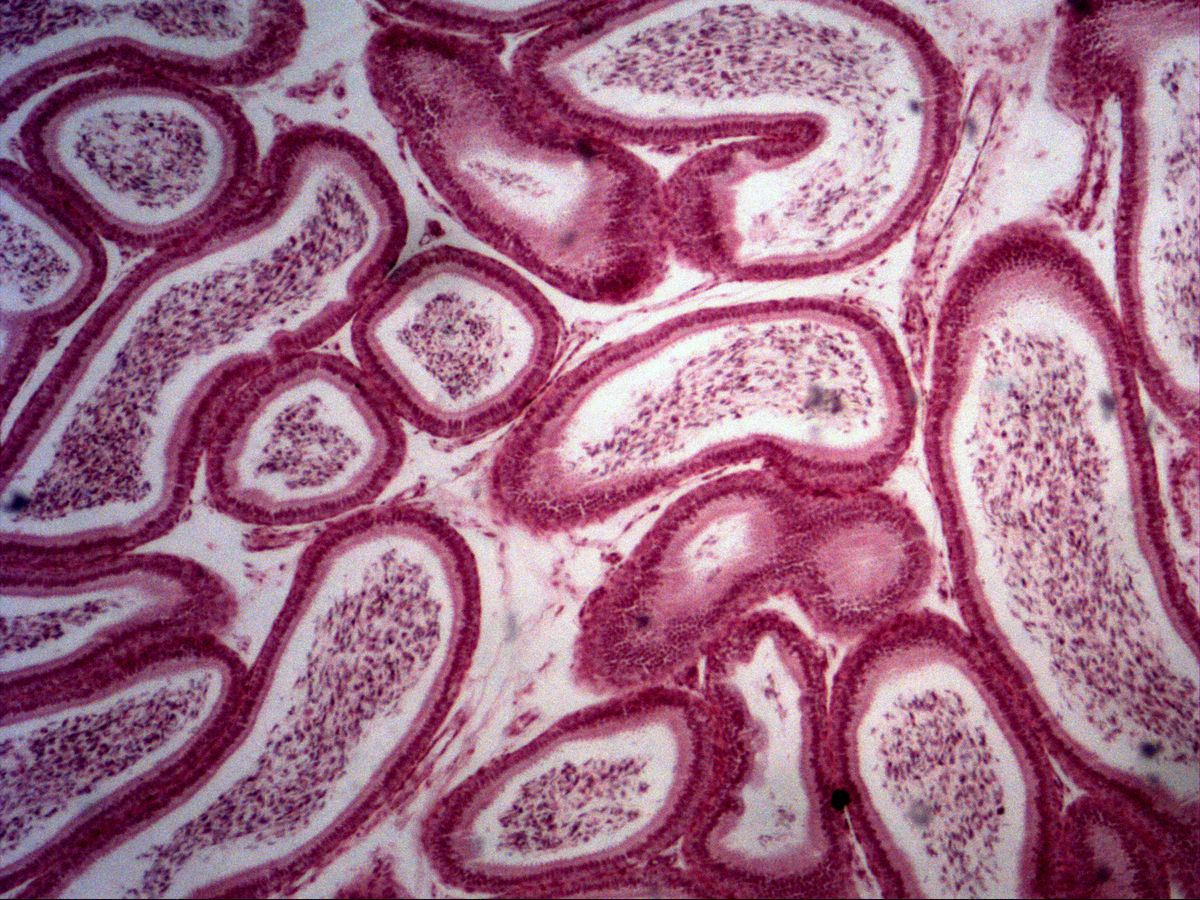Epididymis, H&E, overview: many duct cross-sections with sperm in the lumen
