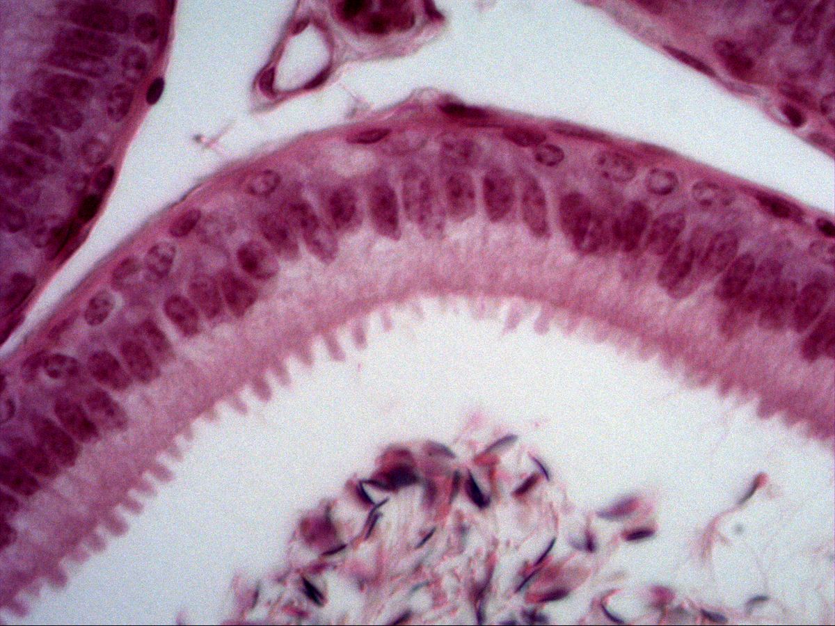 Epididymis, H&E, high power: tall principal cells with tufted stereocilia