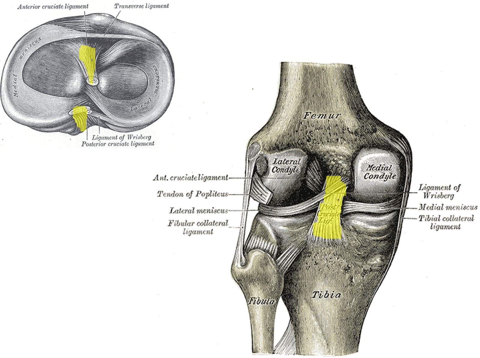 Tibial head from above and knee from behind; cruciate attachments and posterior cruciate ligament in yellow (Gray)