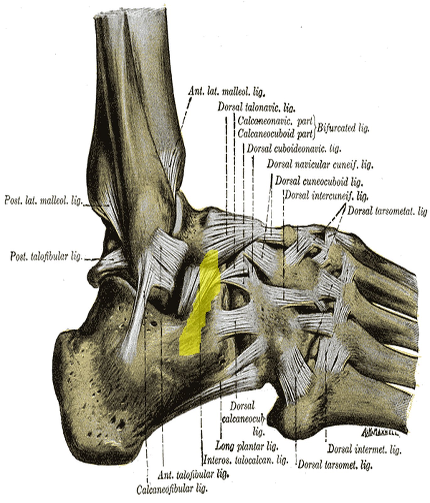 Foot from the lateral side with a ligamentous band on the lateral calcaneus highlighted in yellow (Gray)