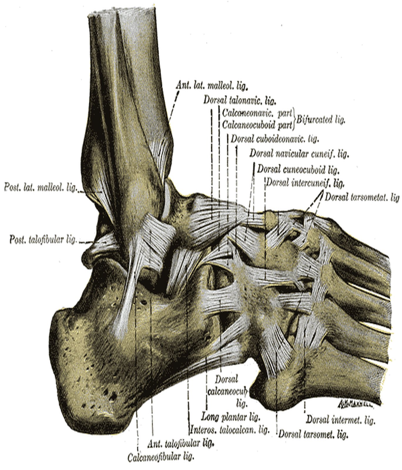 Foot from the lateral side with a ligamentous band on the lateral calcaneus highlighted in yellow (Gray)