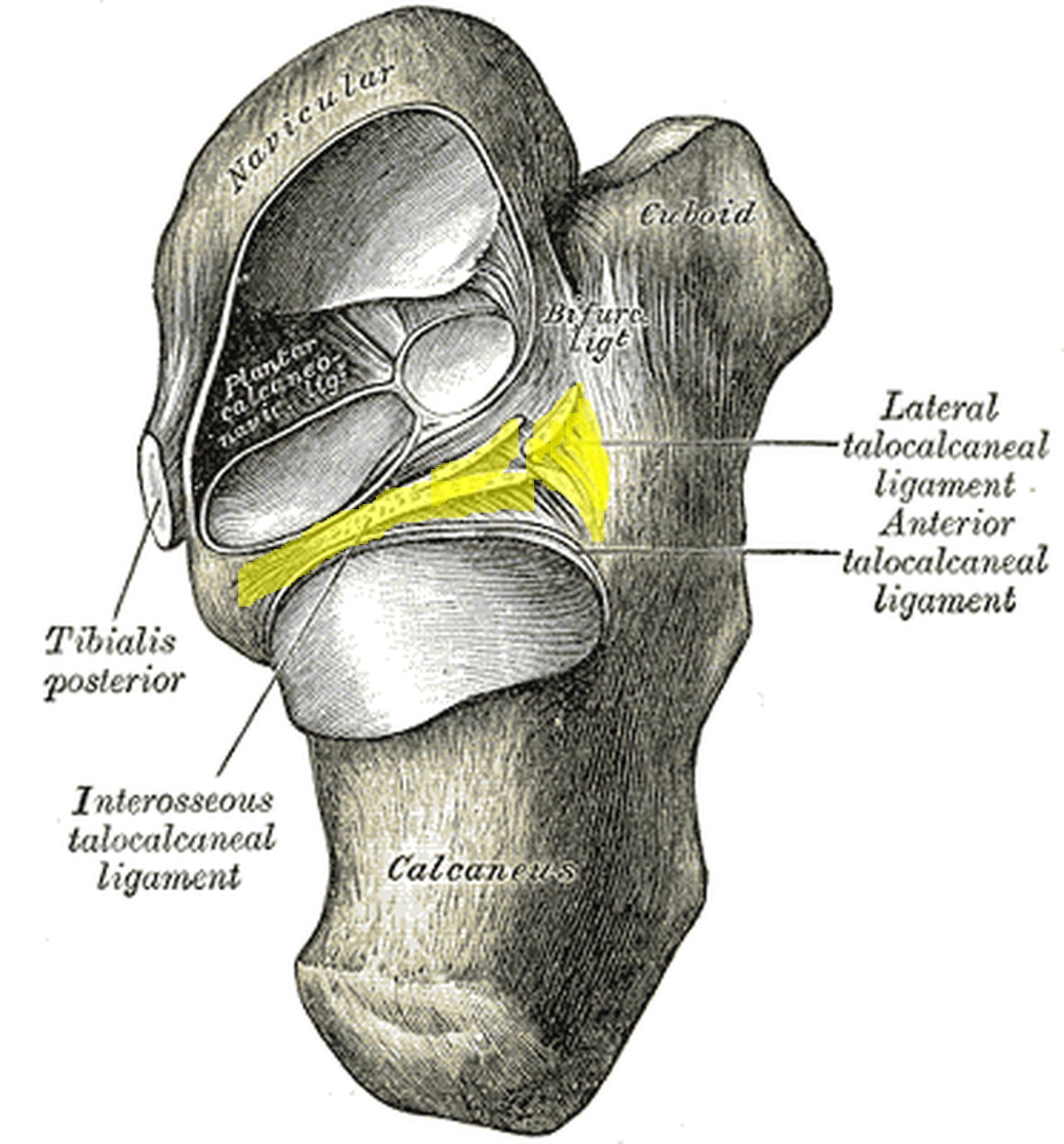 Calcaneus from above with the talus removed; interosseous and lateral talocalcaneal ligaments in yellow (Gray)