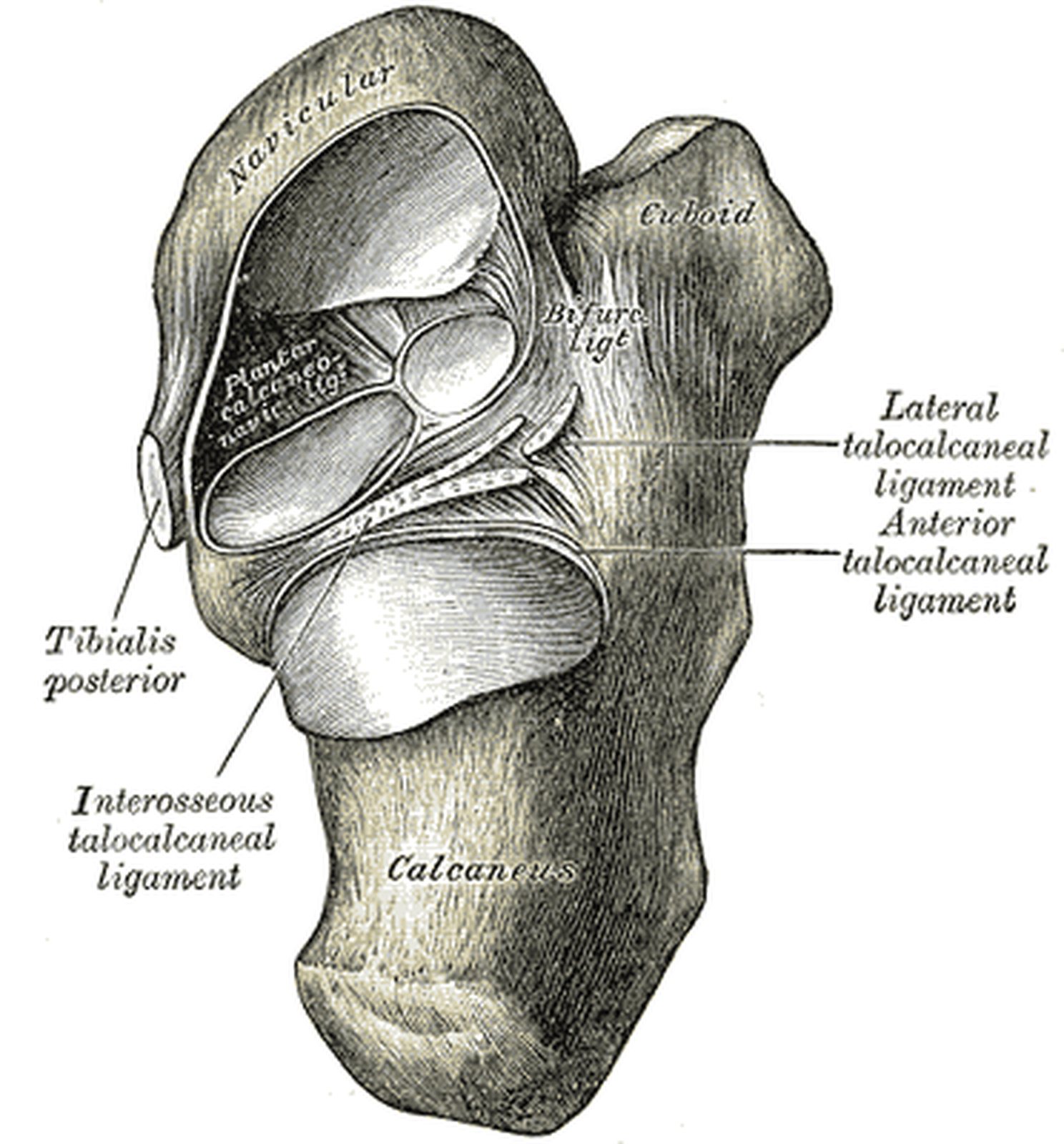 Calcaneus from above with the talus removed; interosseous and lateral talocalcaneal ligaments in yellow (Gray)